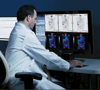 Imagen: Q.Suite les permite a los médicos evaluar la respuesta al tratamiento con más exactitud que nunca antes, haciéndoles posible evaluar cambios biológicos en un paciente durante el curso del tratamiento (Fotografía cortesía de GE Healthcare). Imagen: Q.Suite les permite a los médicos evaluar la respuesta al tratamiento con más exactitud que nunca antes, haciéndoles posible evaluar cambios biológicos en un paciente durante el curso del tratamiento (Fotografía cortesía de GE Healthcare).